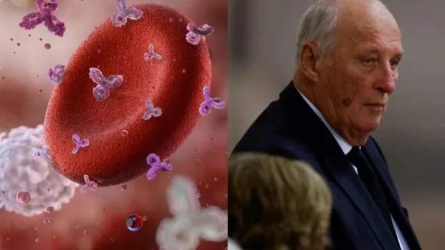 
                    Tipo de anemia que deixa rei em 
