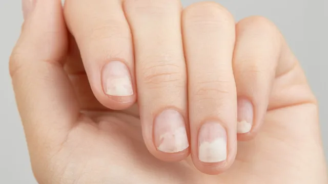 
                    As unhas dizem mais sobre a sua saúde do que imagina
                