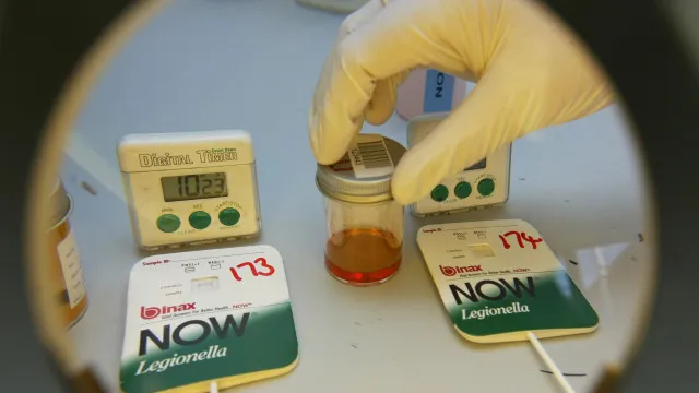 
                    Valongo confirma 2 focos de legionella: Um num estádio e outro em escola
                