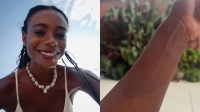 Modelo mostra marcas pelo corpo após ficar três dias desaparecida
