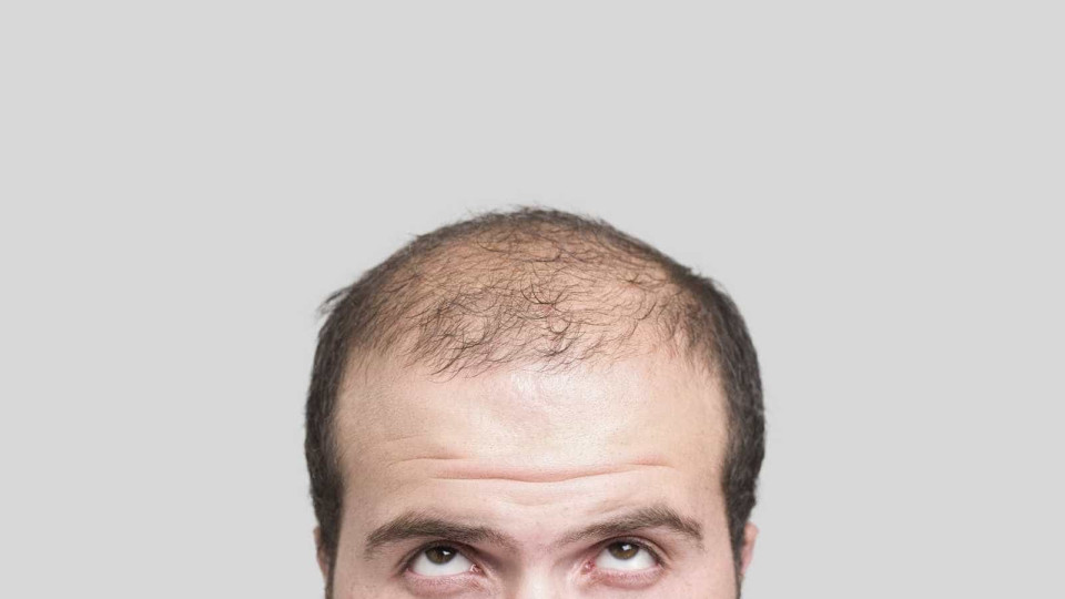 As quatro únicas formas de abrandar a perda de cabelo