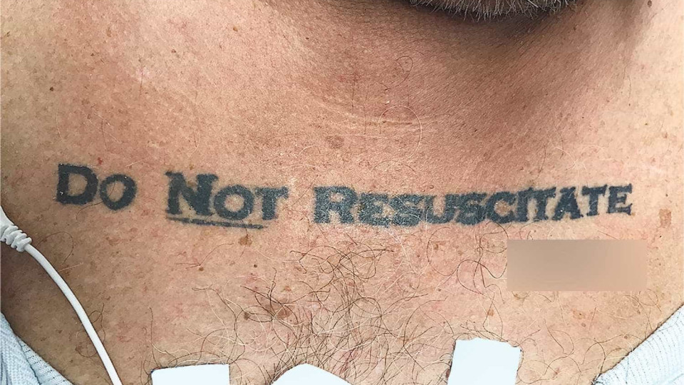 "Não ressuscitar". A tatuagem que criou um problema ético aos médicos