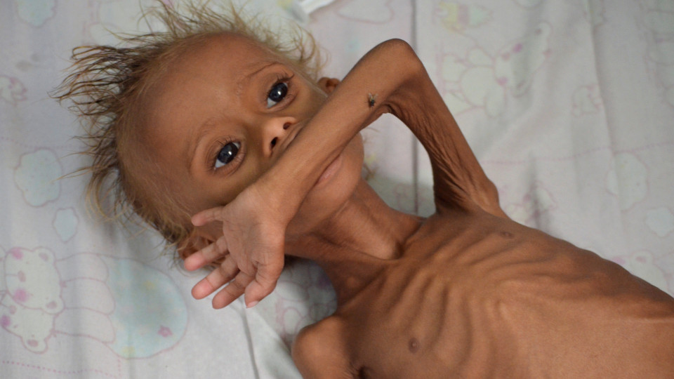 Cerca de 12 milhões de iemenitas em risco de fome nos próximos meses