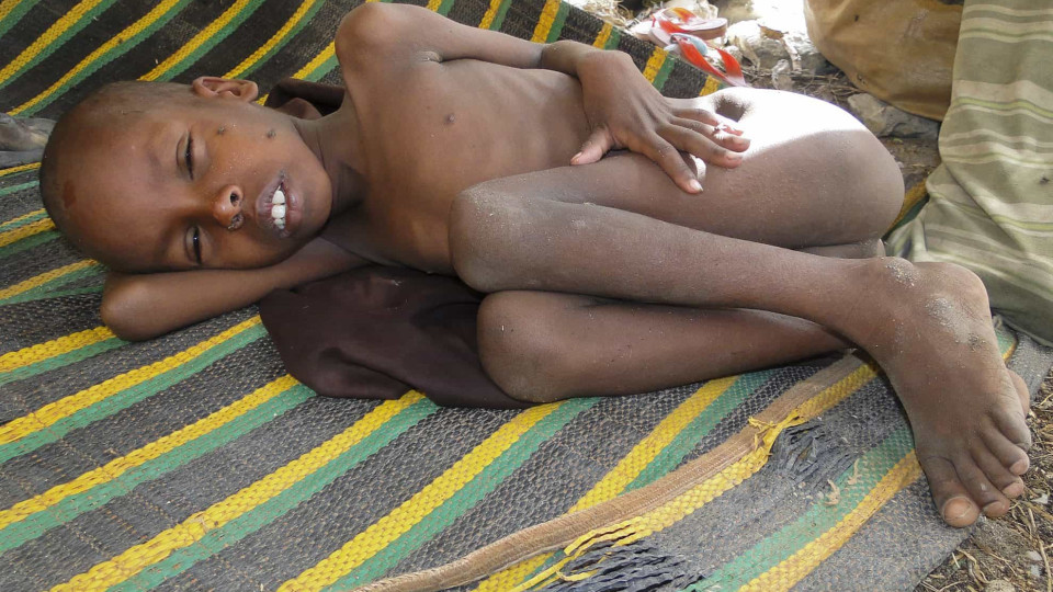 Malnutrição provocou este ano 364 mortes de crianças angolanas na Huíla