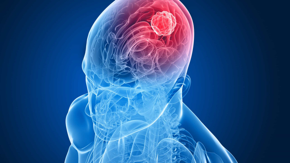 Cancro da cabeça e do pescoço: Apenas 27% das pessoas conhecem sintomas