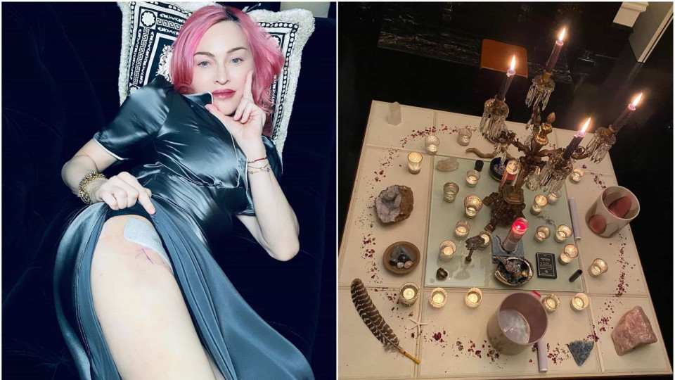 Madonna chamada de bruxa após mostrar misterioso ritual e marcas na perna