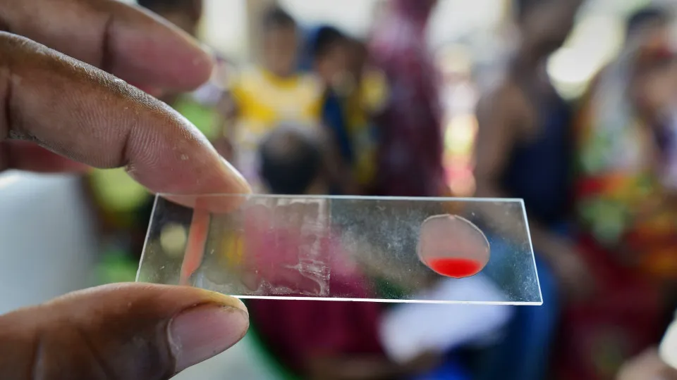 Novo teste sanguíneo deteta tuberculose mais depressa e com mais eficácia