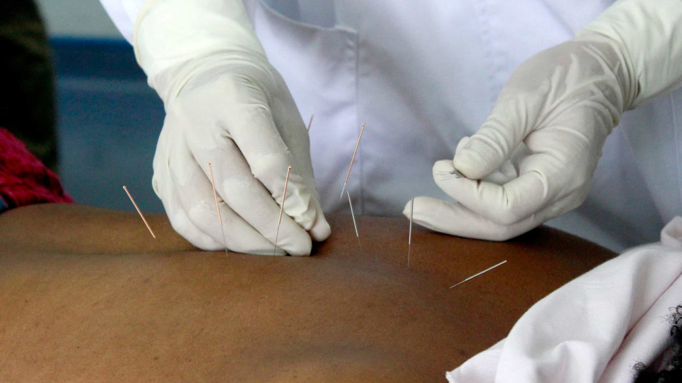 Médicos chineses rompem obstáculos da língua e levam acupuntura a Angola