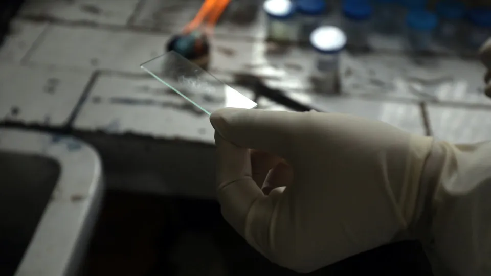 Portugal regista 1.584 casos de tuberculose em 2023