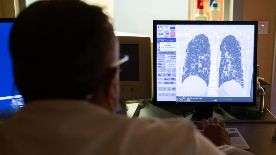 Covid-19: Pneumologistas alertam para importância do diagnóstico precoce na DPOC