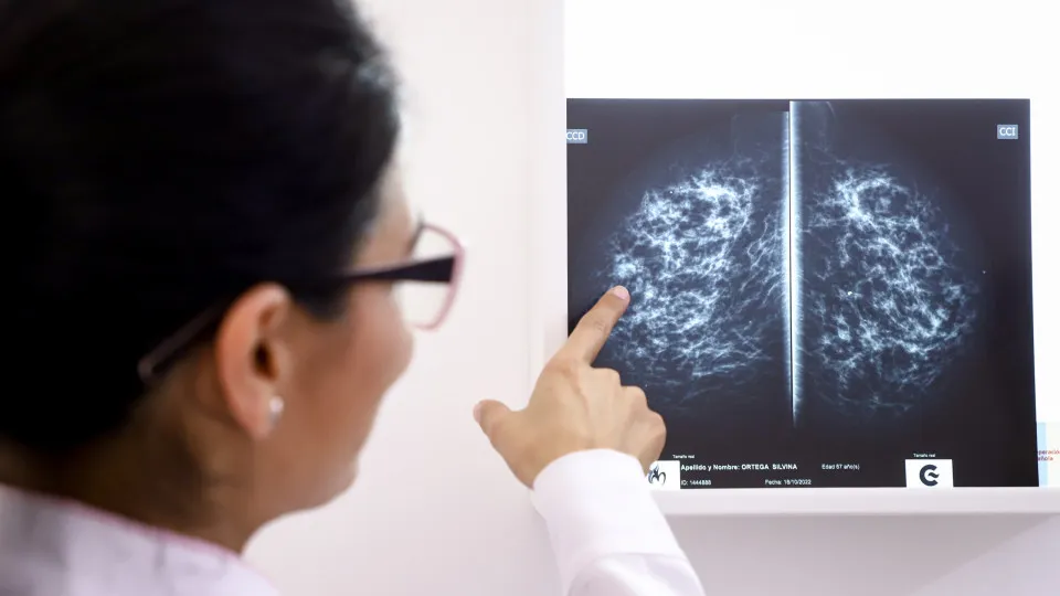 Estudo europeu para detetar risco de cancro da mama em mulheres jovens abrange hospital de Lisboa
