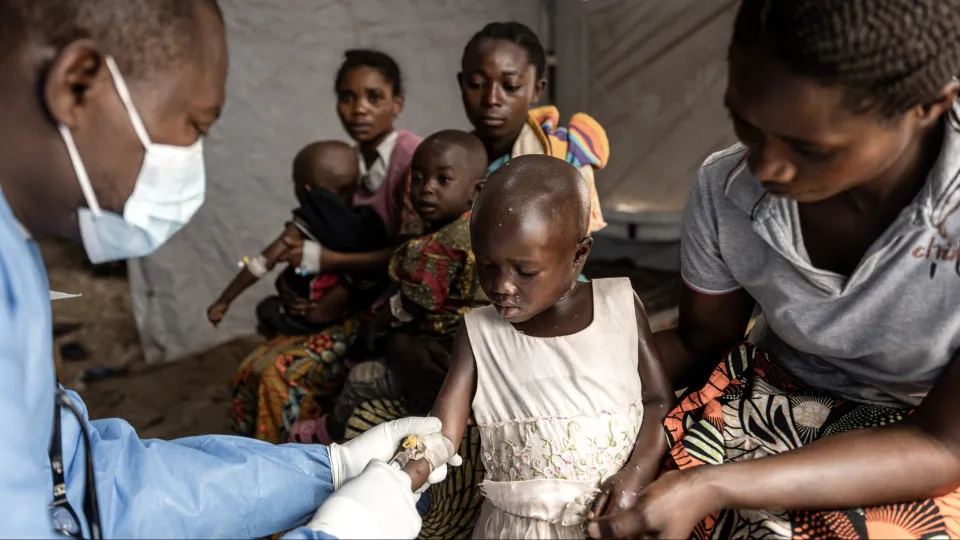 Quase um terço dos infetados com Mpox no Burundi tem menos de 5 anos, segundo a UNICEF