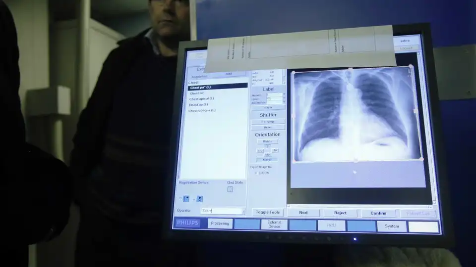 Tuberculose mata uma criança cada 3 minutos. Situação é pior em 14 países