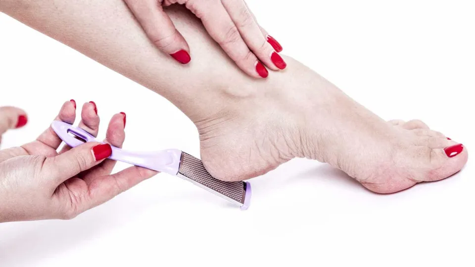 Faz ou não mal remover as calosidades dos pés?