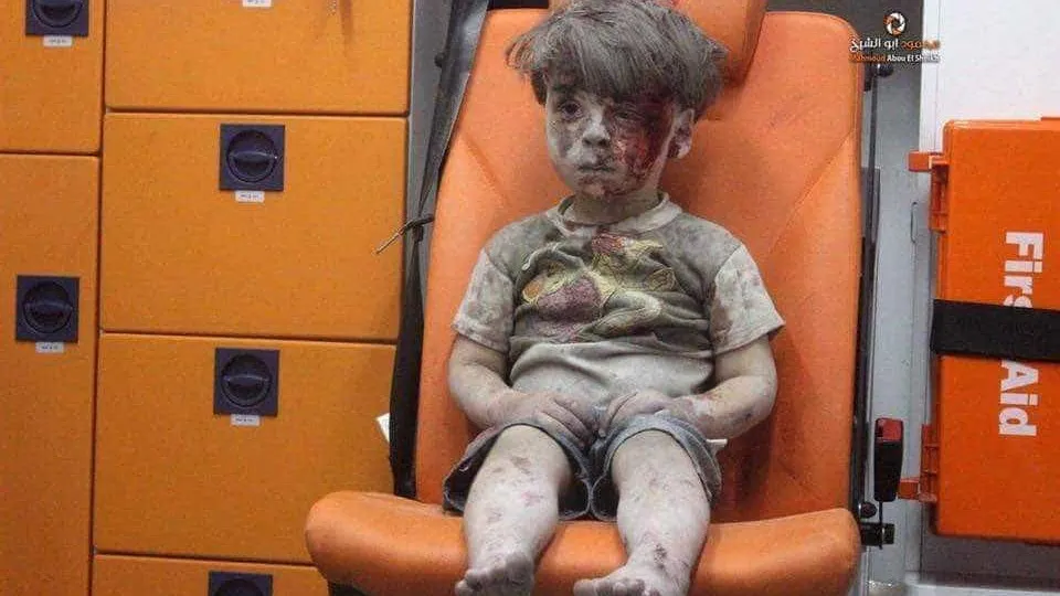Omran está ferido, não tem lágrimas e é o novo rosto da guerra na Síria