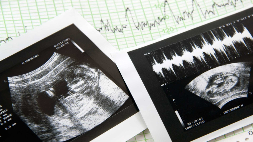 Nebraska proíbe aborto às 12 semanas de gravidez