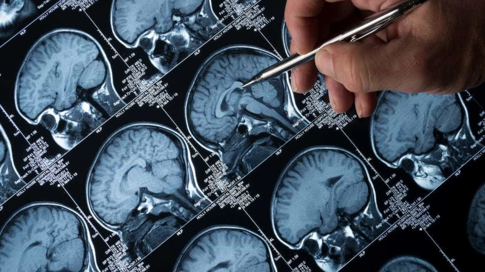 Prémio distingue trabalho sobre tumor cerebral maligno comum em crianças