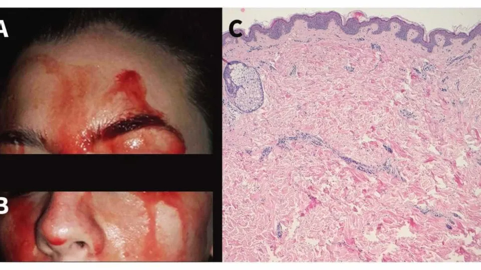 O estranho caso da mulher que sua sangue