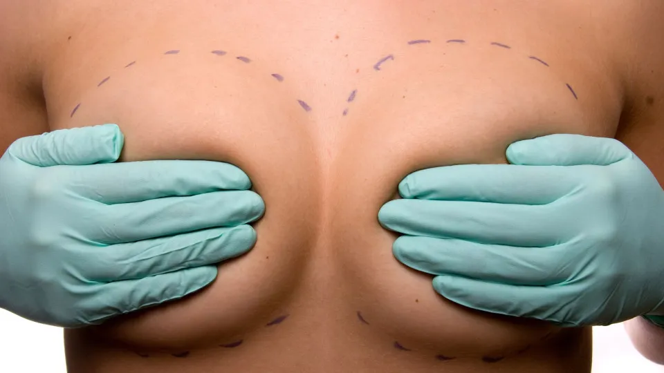 Será que provoca cancro da mama? Desvende 8 mitos sobre a mamoplastia