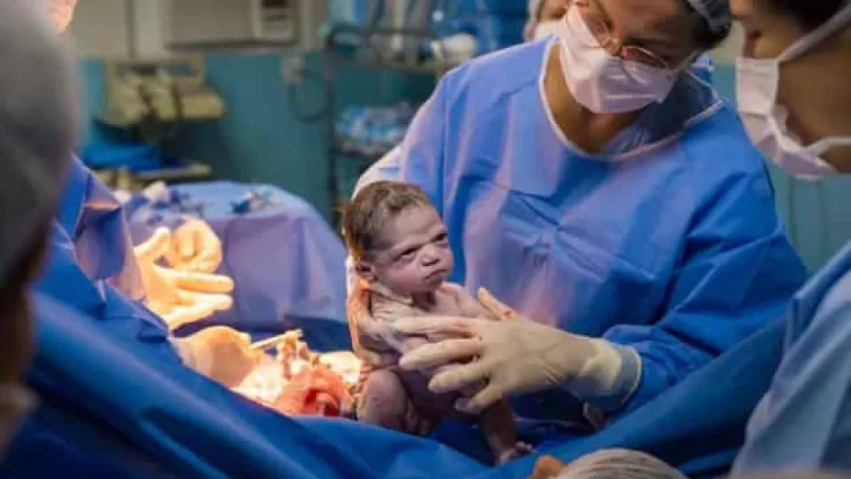 Bebé nasce com cara de zangada e foto torna-se viral