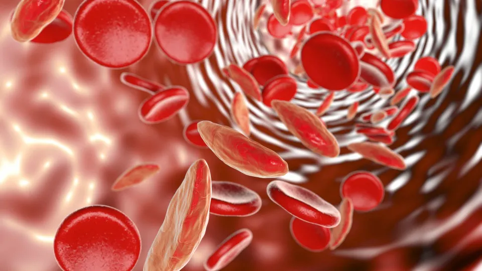 Anemia, glóbulos vermelhos