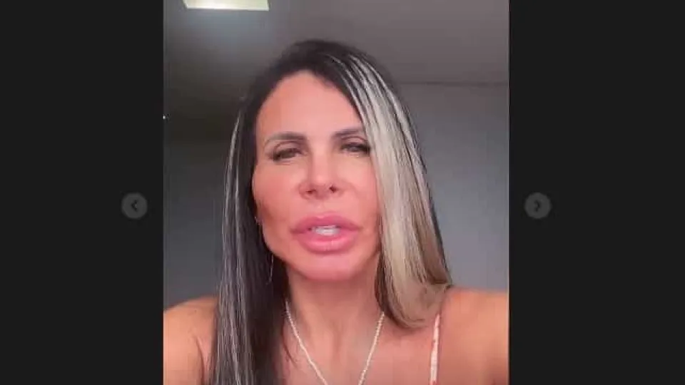 Cantora Gretchen faz procedimento estético ao rosto. Eis o resultado