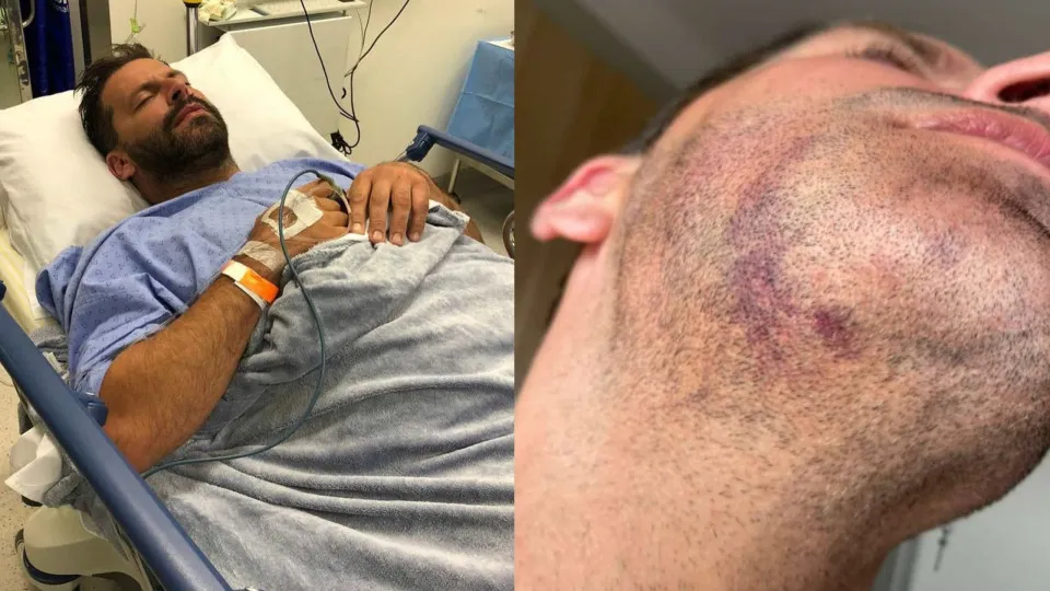 Ator brasileiro Henri Castelli é agredido e fica ferido com gravidade