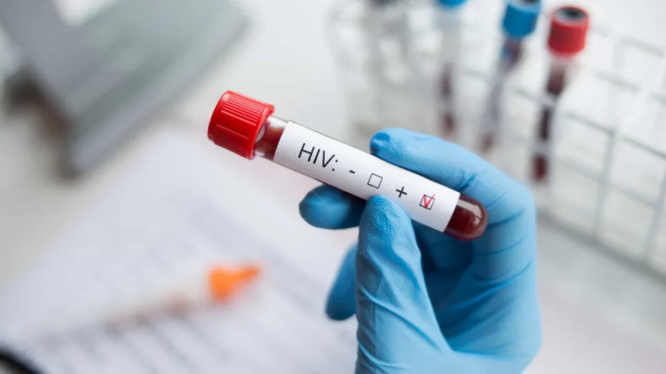 VIH, HIV, SIDA