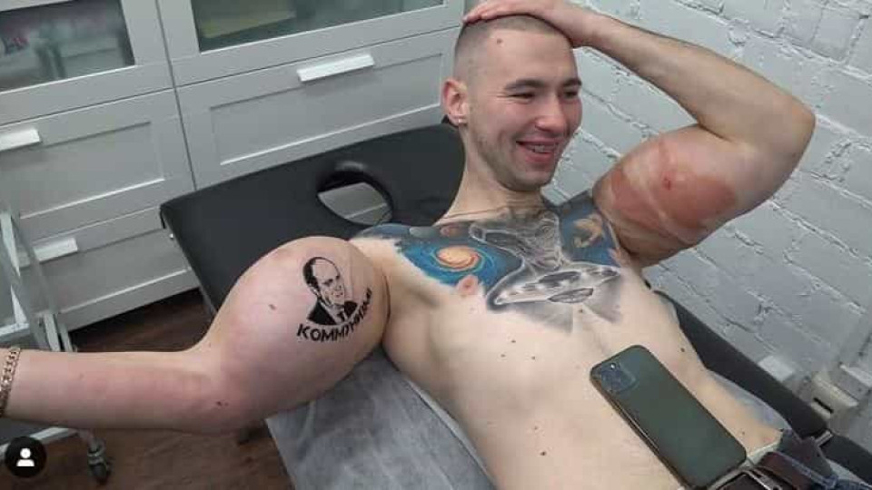 Popeye russo corre risco de amputação após braço 'explodir' durante luta
