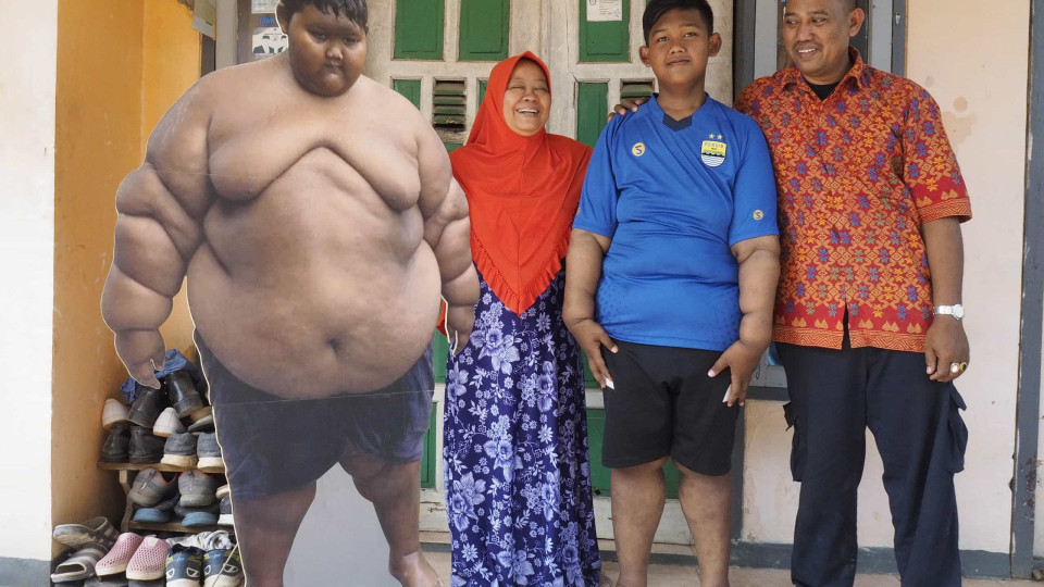 Menino mais obeso do mundo perdeu 100 kg. Ainda faltam várias operações