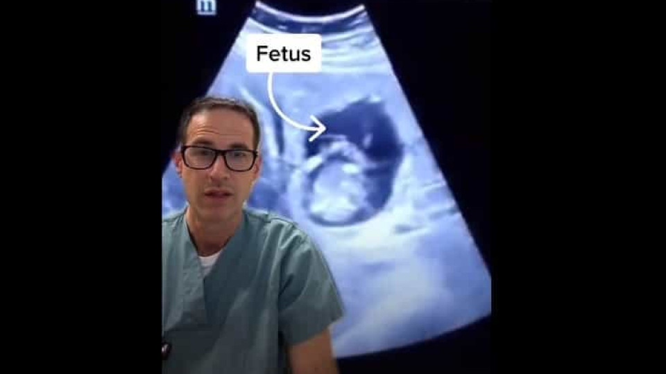 Caso inédito: Mulher grávida descobre que tem feto no fígado