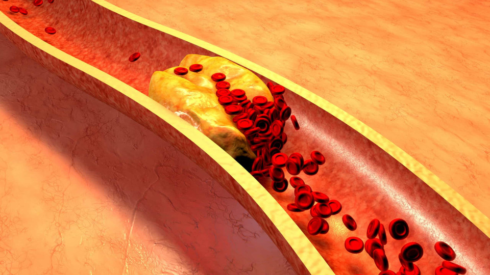 Colesterol no limite? Estes alimentos altamente improváveis vão ajudá-lo
