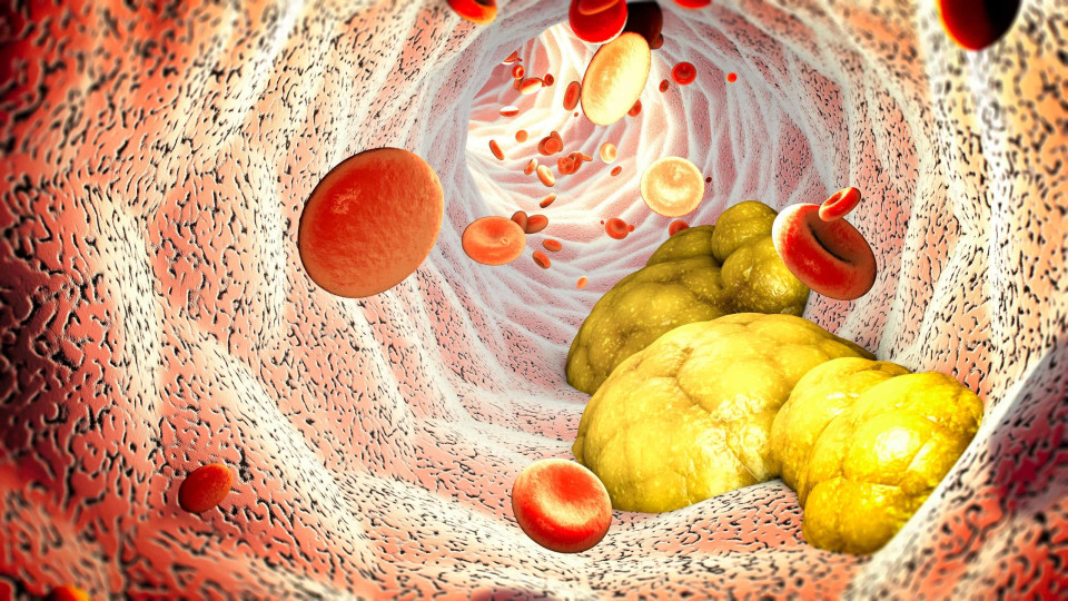 O fruto instagramável que ataca o colesterol perigosamente elevado