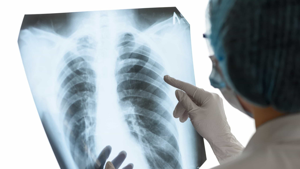 Covid: Aprendizagem profunda pode tornar diagnóstico por raio-X "fiável"