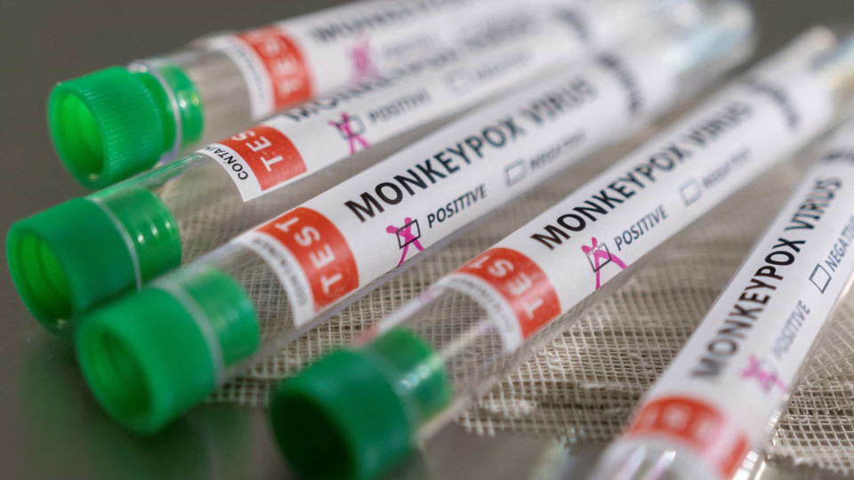 Monkeypox: 11 novos sintomas que podem facilmente passar despercebidos