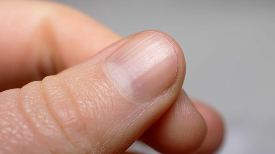 Sabe o que significam os pequenos relevos que tem nas unhas?