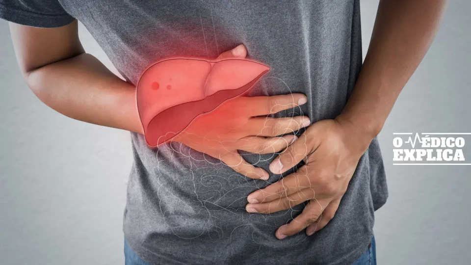 Esteatose hepática. A doença 'silenciosa' que pode levar ao cancro