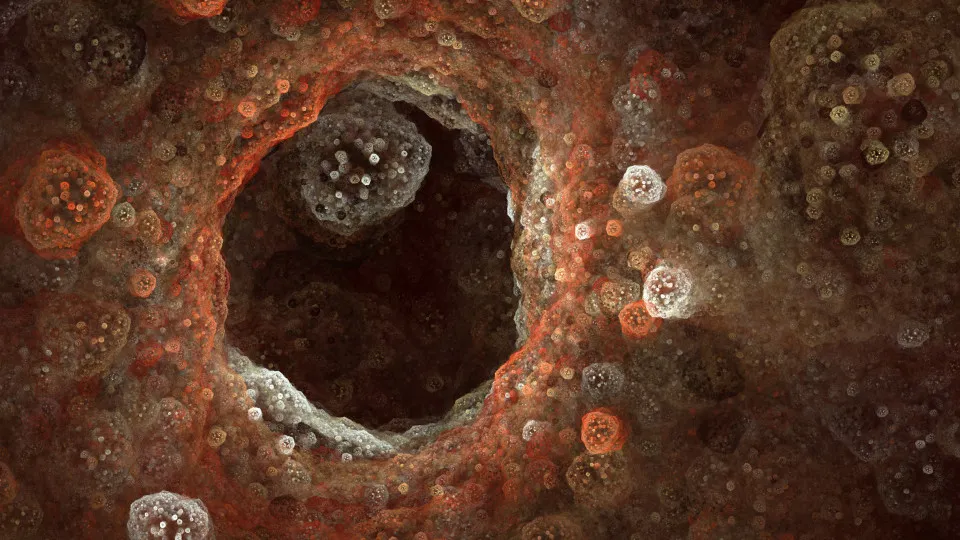 Estudo. Covid longa pode evoluir para cancro ou insuficiência hepática