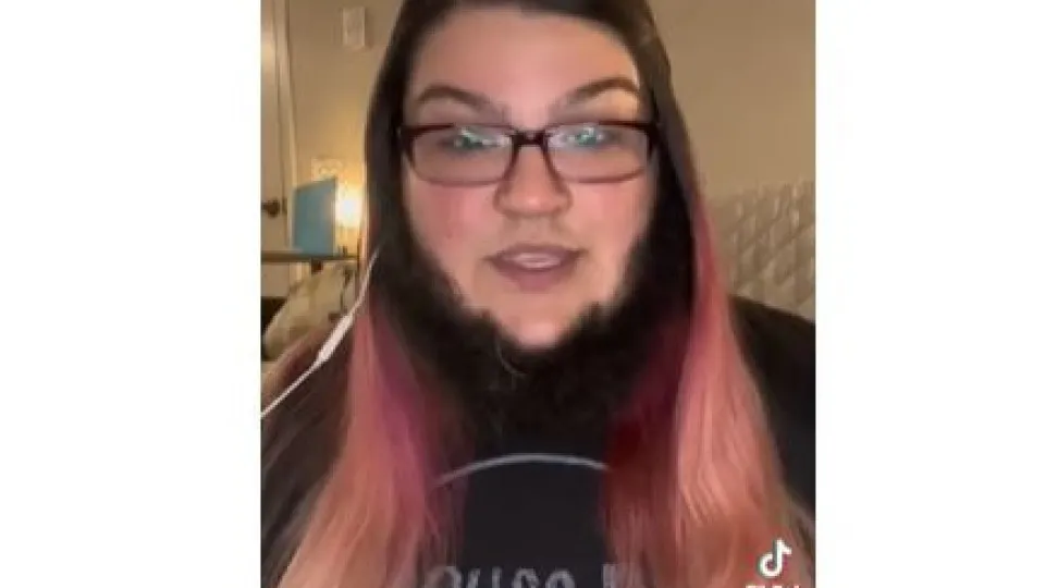 "Sinto-me bonita". Mulher fez a barba durante 16 anos e agora assumiu-a