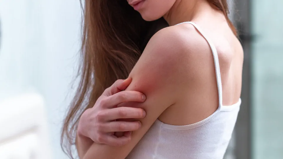 Para afastar os mosquitos (no verão) aposte em roupa com estas cores