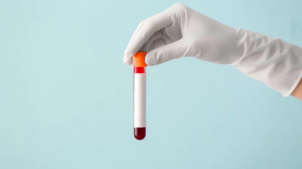 Vai fazer análises ao sangue? Então, evite este tipo de comida
