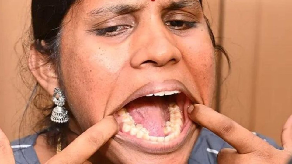 Mulher com 38 dentes entra para o Guinness