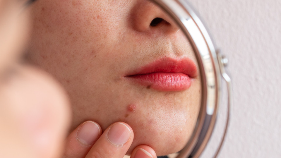 As rotinas de 'skincare' que danificam a pele - e aumentam a acne