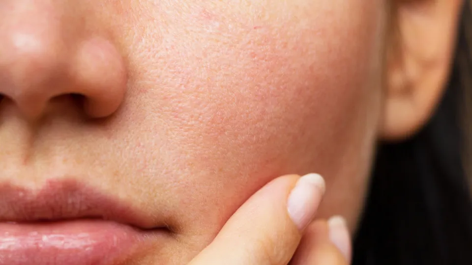 Tem a pele seca? Quatro ingredientes de 'skincare' em que deve apostar