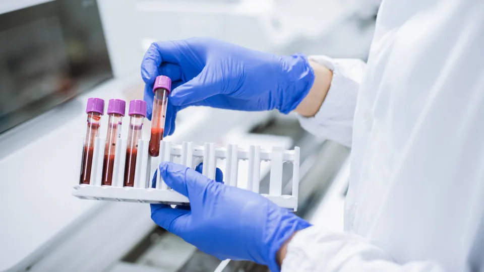Sangue, Análise, Laboratório 