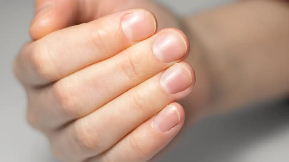 Siga estas dicas e mantenha as unhas sempre limpas e cuidadas