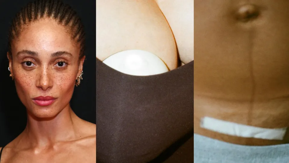 Adwoa Aboah exibe cicatriz de cesariana e revela que está a amamentar