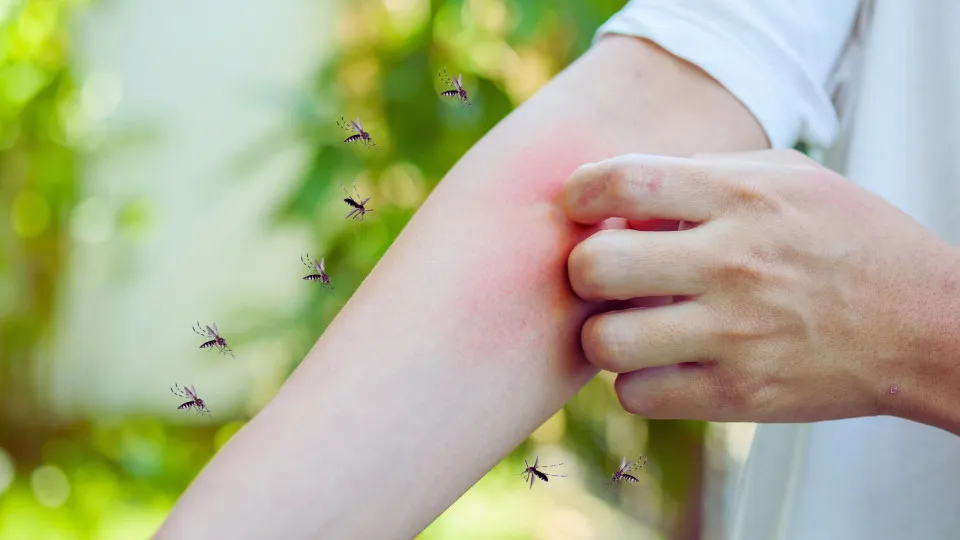 mosquitos, mordida