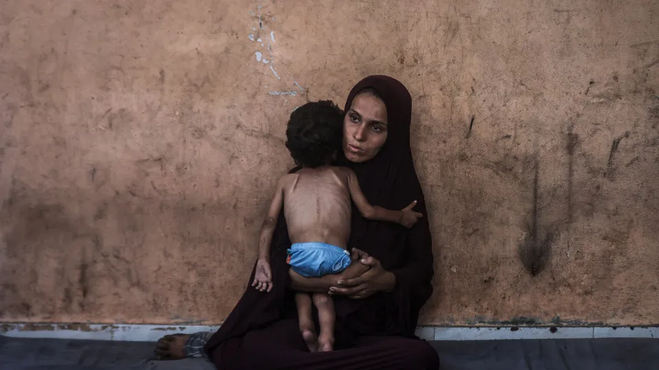 criança, desnutrição, fome, faixa de gaza