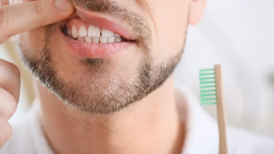 doenças, gengivas, homem, dentes
